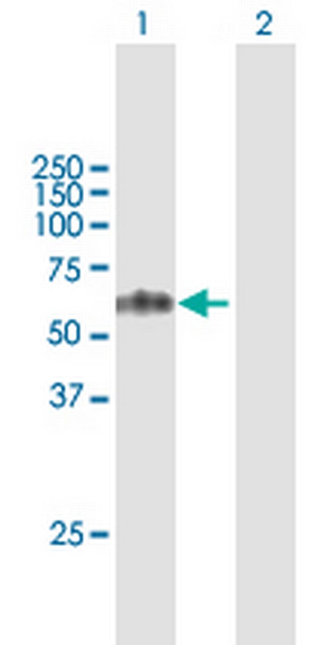 TCN1 Antibody in Western Blot (WB)