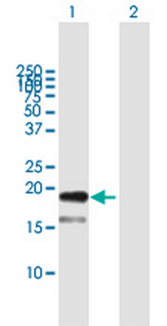 TDGF1 Antibody in Western Blot (WB)