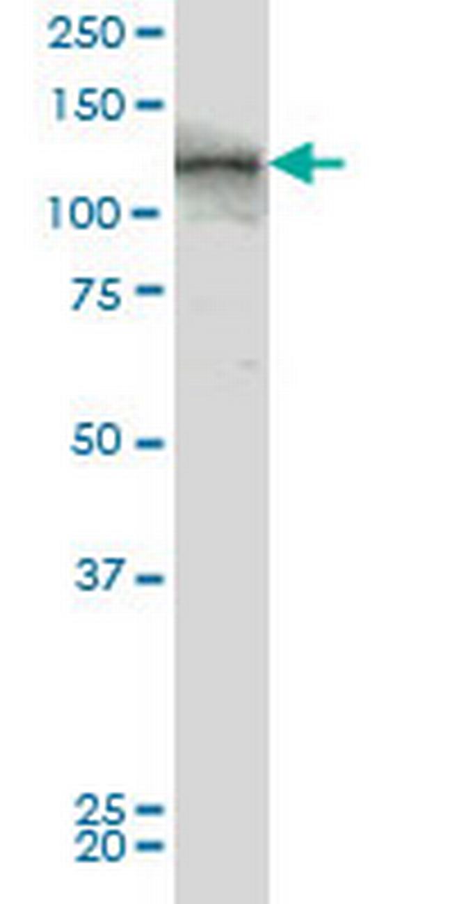 TEK Antibody in Western Blot (WB)