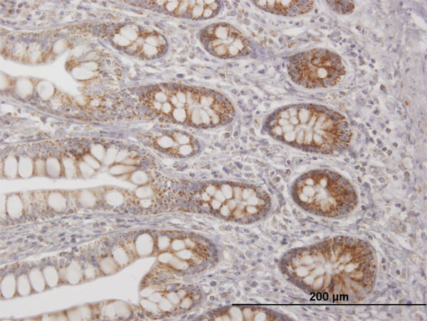 TFAM Antibody in Immunohistochemistry (Paraffin) (IHC (P))