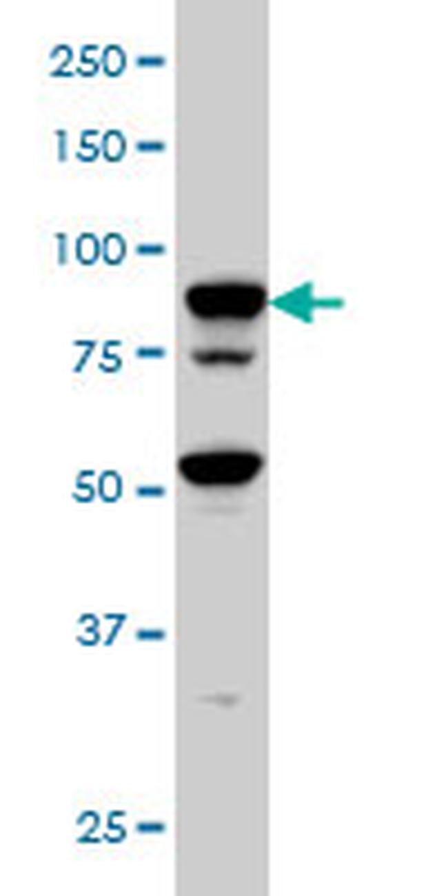 TFRC Antibody in Western Blot (WB)