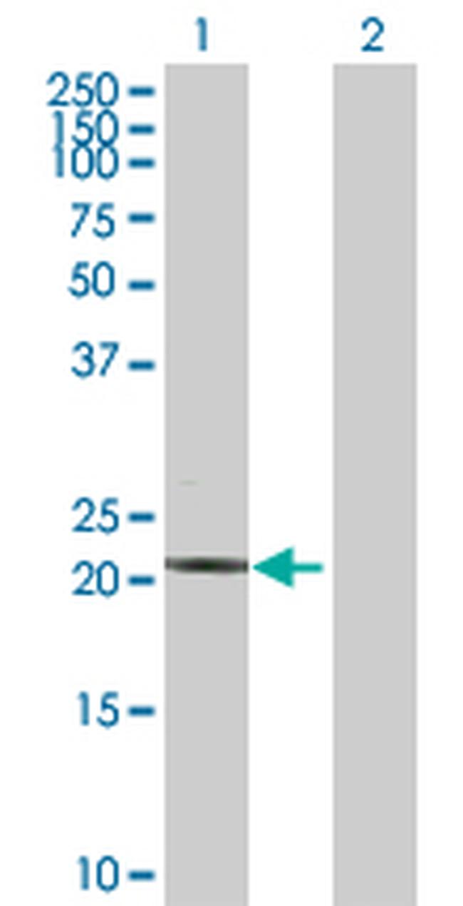 TNNI2 Antibody in Western Blot (WB)