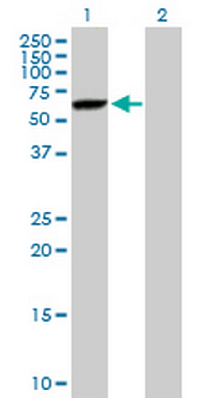 DNAJC7 Antibody in Western Blot (WB)