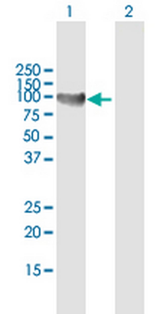 TTK Antibody in Western Blot (WB)