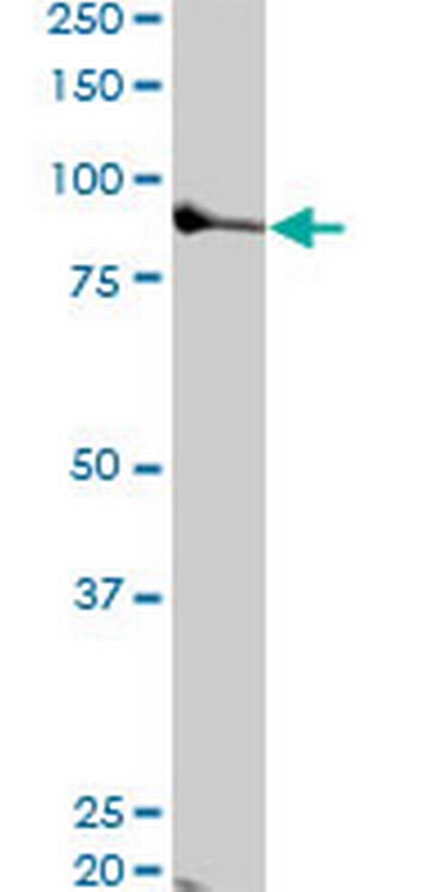 TTK Antibody in Western Blot (WB)