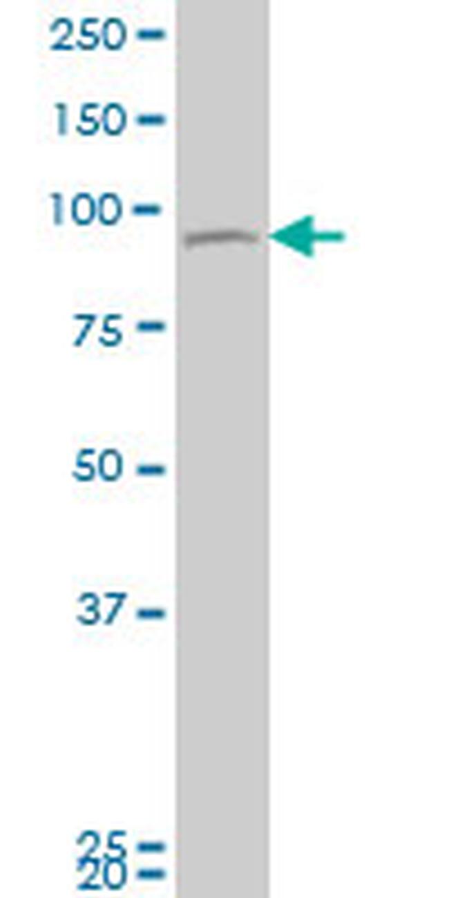 TTK Antibody in Western Blot (WB)