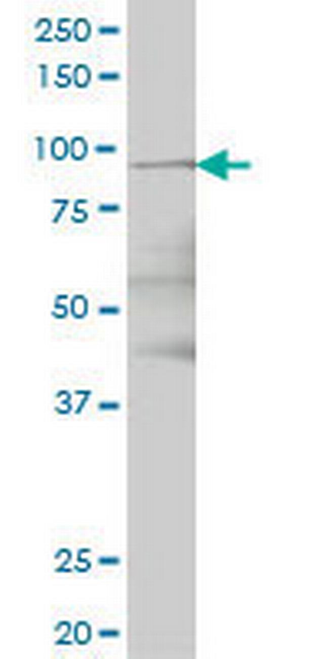 TTK Antibody in Western Blot (WB)