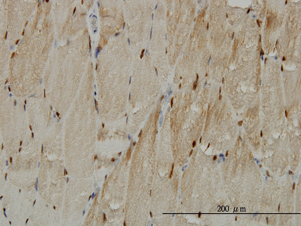 TTN Antibody in Immunohistochemistry (Paraffin) (IHC (P))