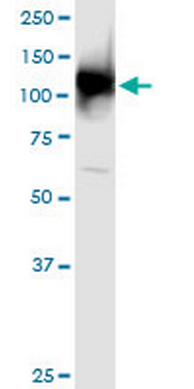 UBA1 Antibody in Western Blot (WB)