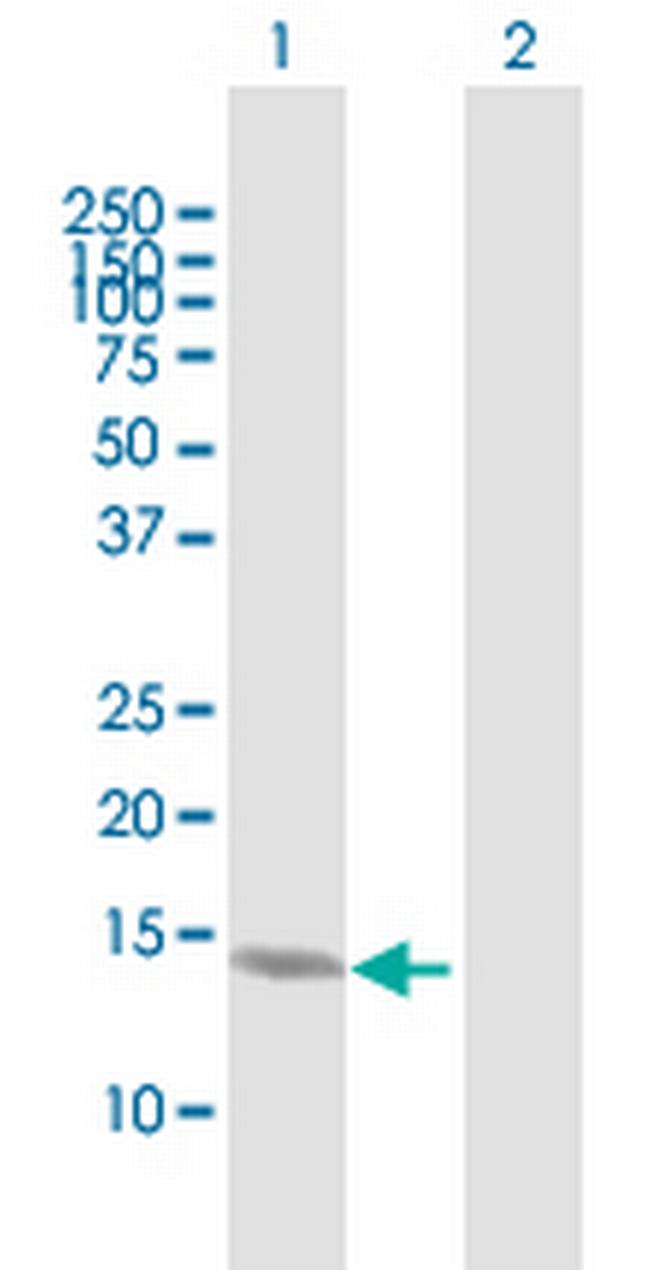 SUMO1 Antibody in Western Blot (WB)