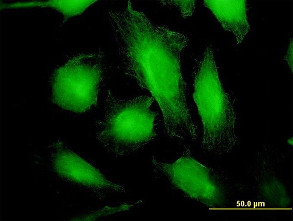 WARS Antibody in Immunocytochemistry (ICC/IF)