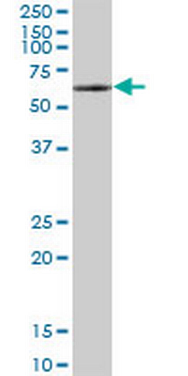 WHSC2 Antibody in Western Blot (WB)