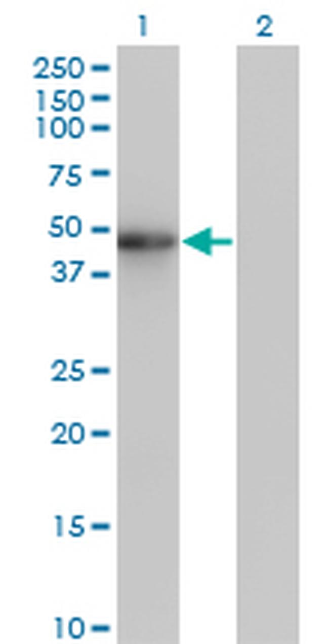 ZNF24 Antibody in Western Blot (WB)