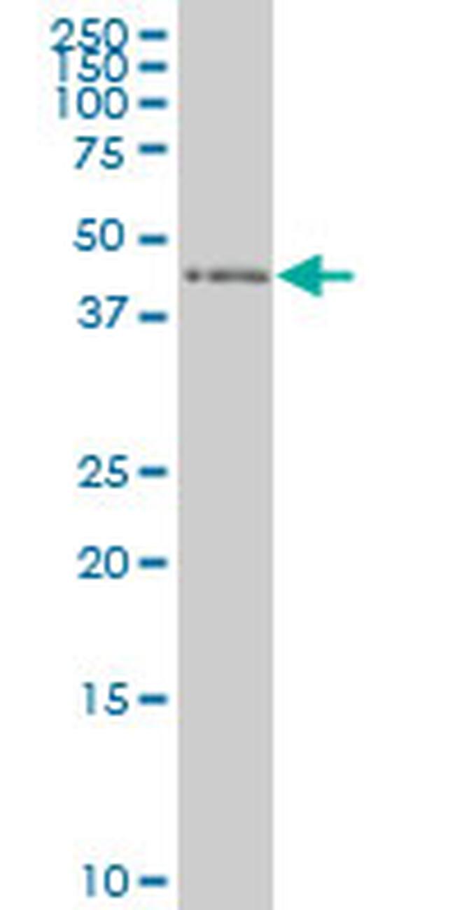 ZNF24 Antibody in Western Blot (WB)