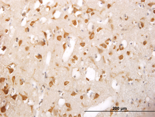 TRIM25 Antibody in Immunohistochemistry (Paraffin) (IHC (P))