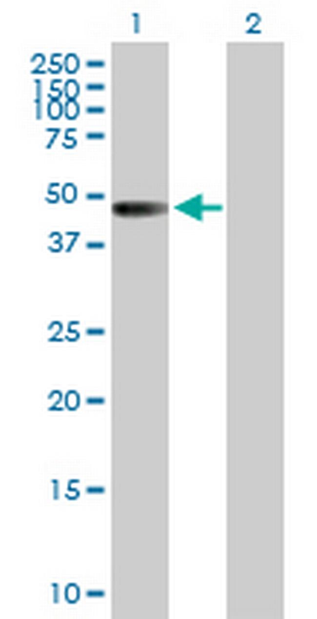 ZNF193 Antibody in Western Blot (WB)