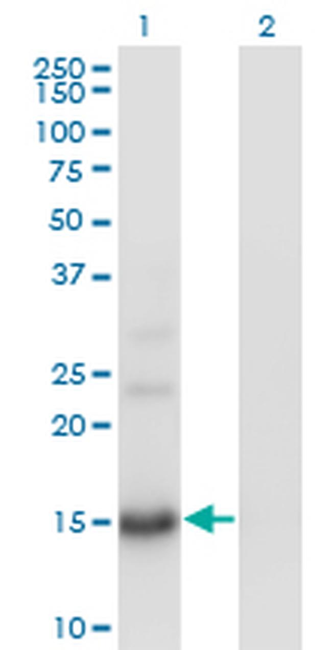 BTG2 Antibody in Western Blot (WB)