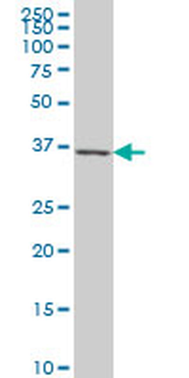 CXCR4 Antibody in Western Blot (WB)