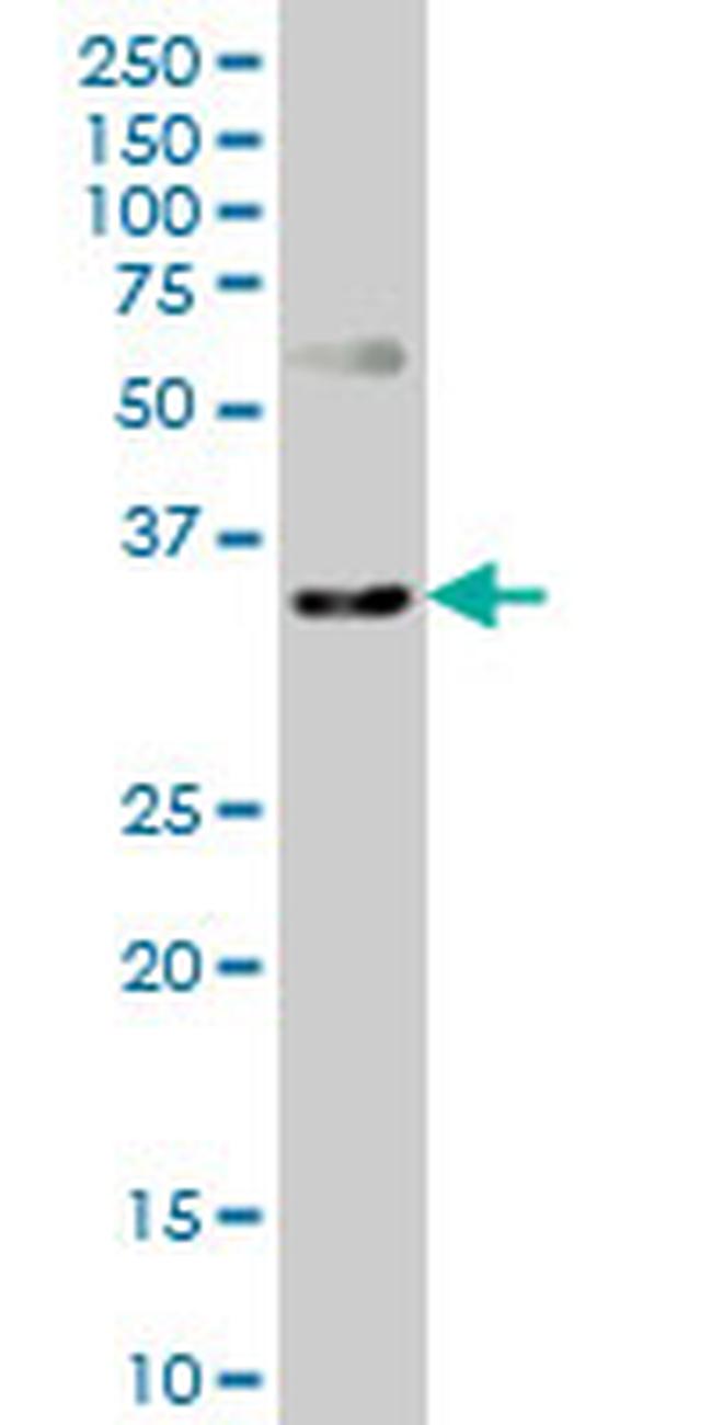 CXCR4 Antibody in Western Blot (WB)