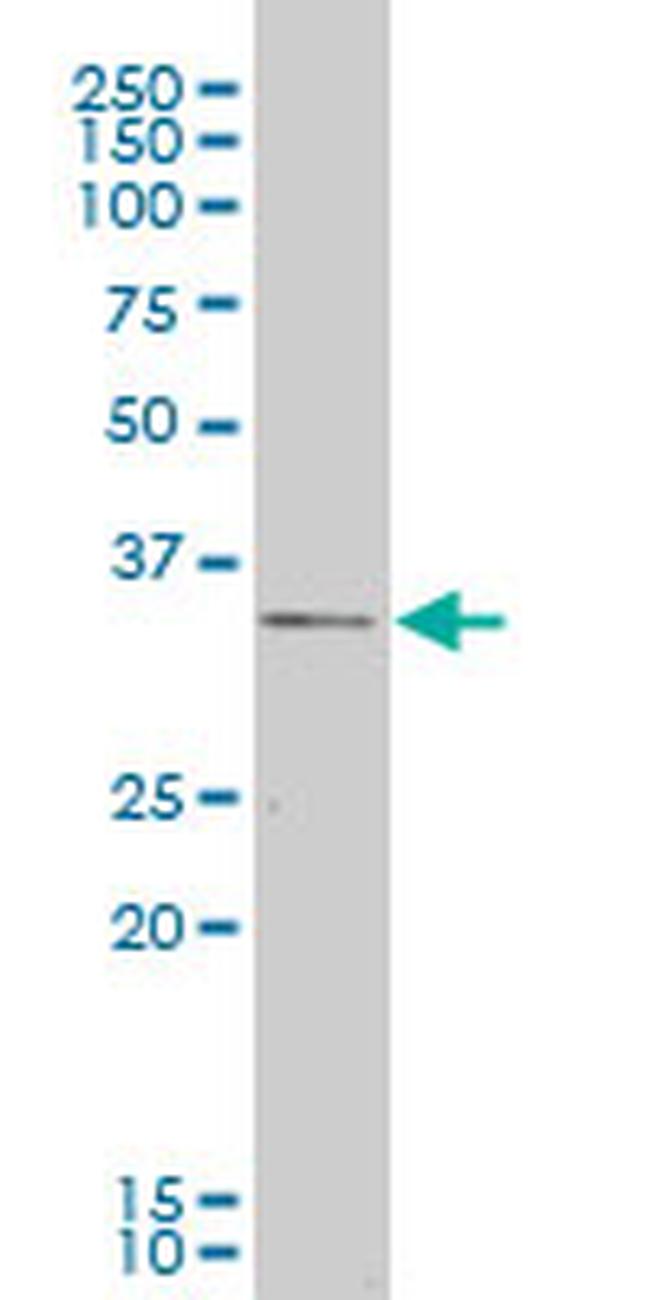 CXCR4 Antibody in Western Blot (WB)