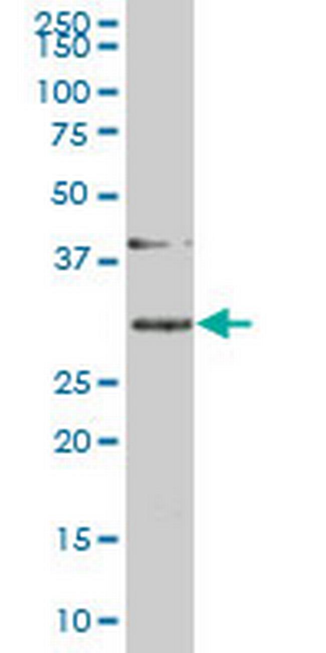 SLBP Antibody in Western Blot (WB)