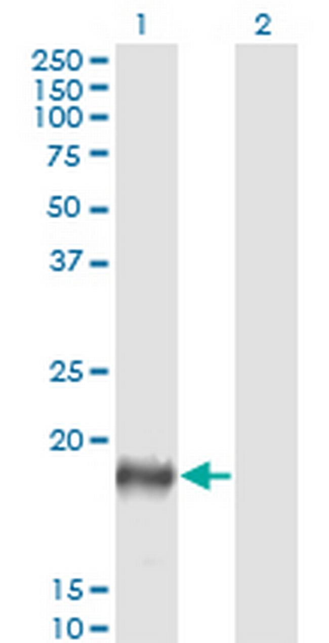 PSCA Antibody in Western Blot (WB)