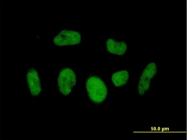 BRD3 Antibody in Immunocytochemistry (ICC/IF)