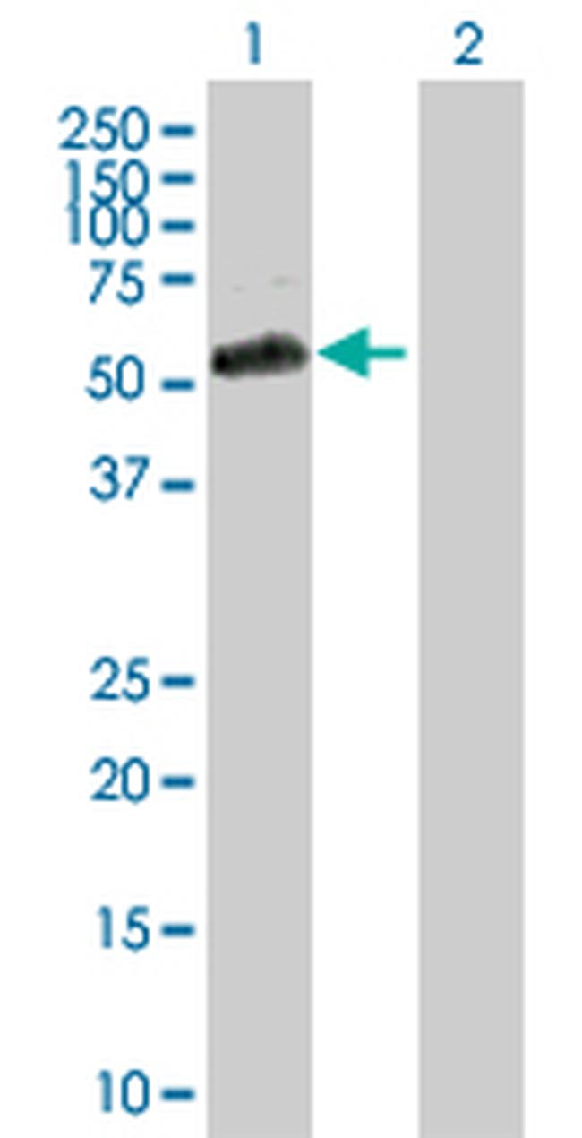 BRD3 Antibody in Western Blot (WB)