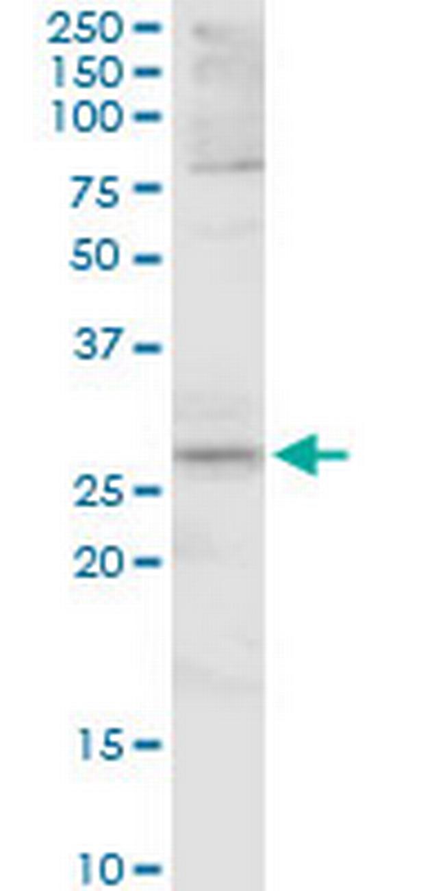 FOSL1 Antibody in Western Blot (WB)