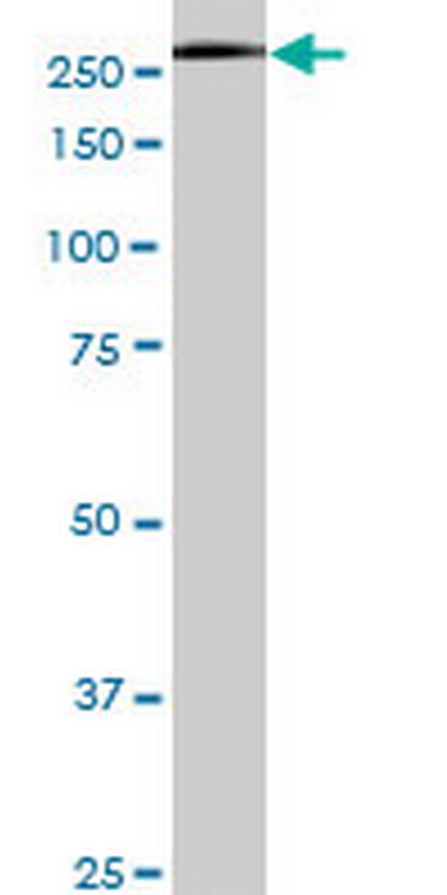 USP9X Antibody in Western Blot (WB)