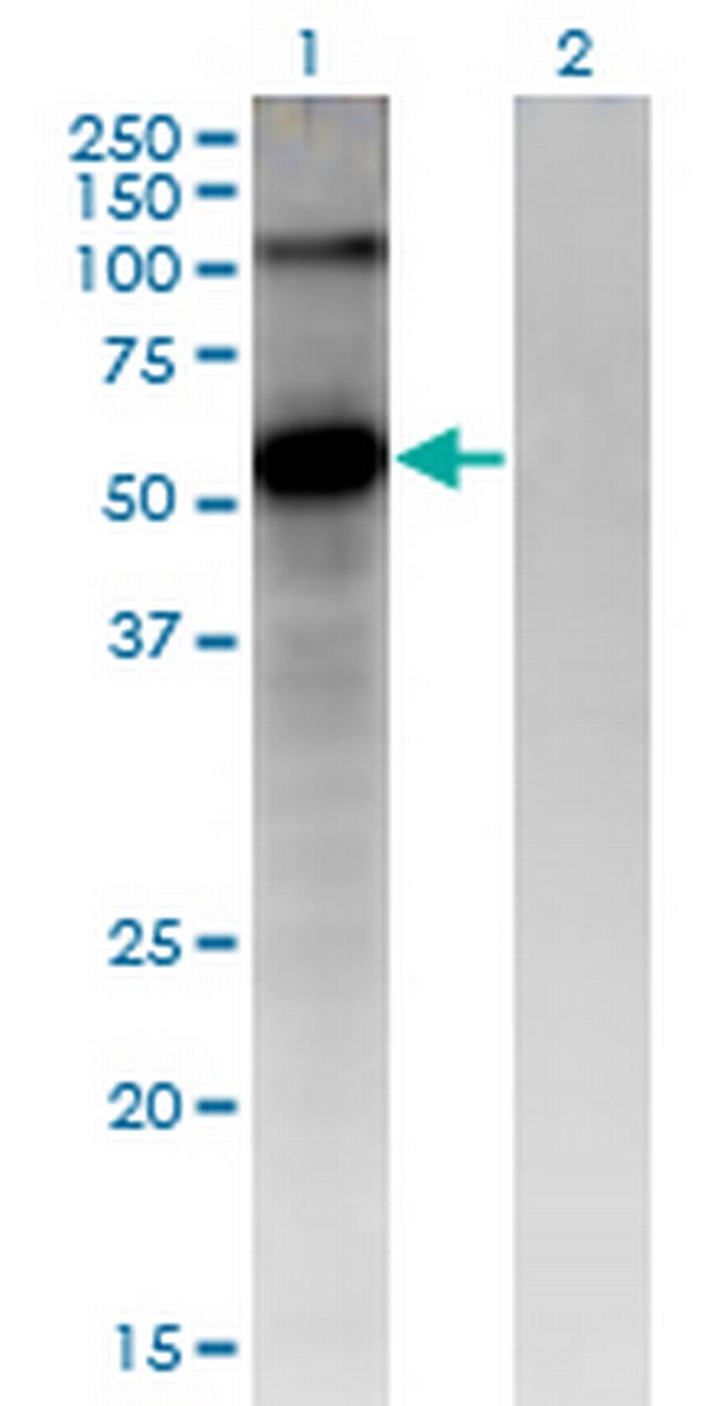 FZD4 Antibody in Western Blot (WB)