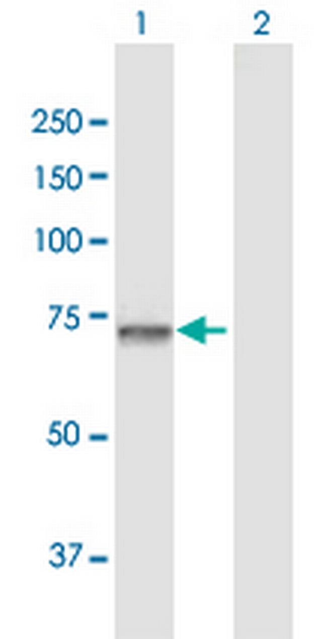 GNPAT Antibody in Western Blot (WB)