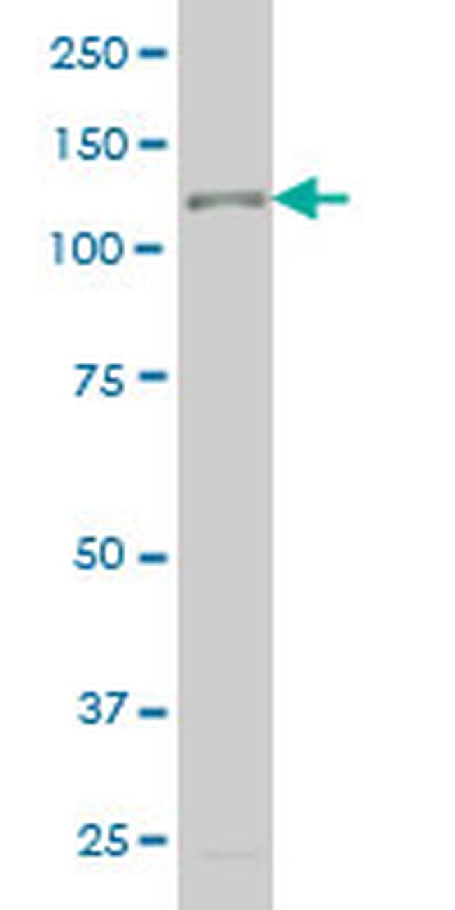 TTF2 Antibody in Western Blot (WB)