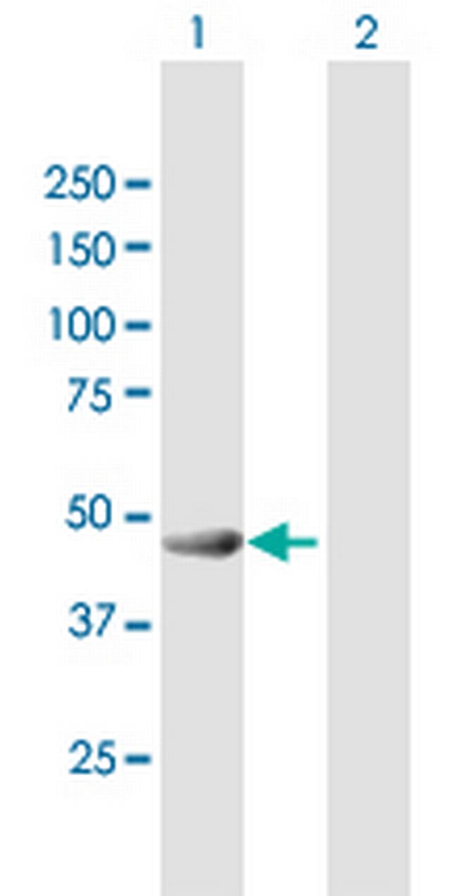 GAS7 Antibody in Western Blot (WB)