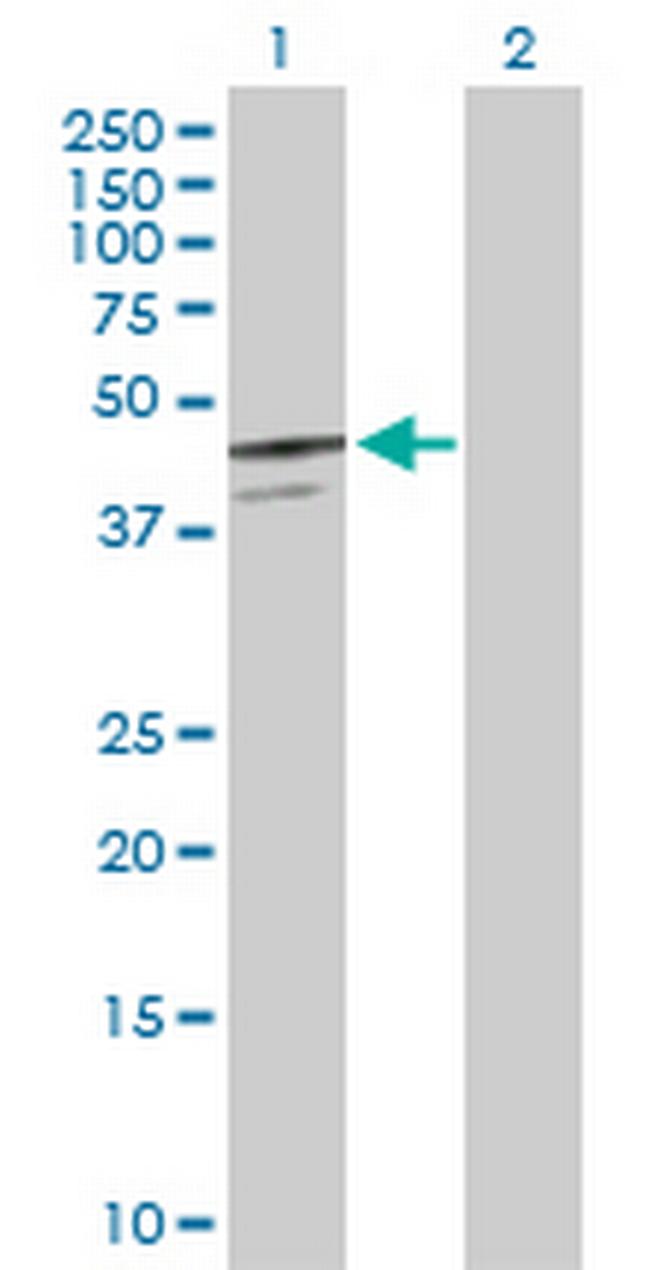 SERPINB7 Antibody in Western Blot (WB)