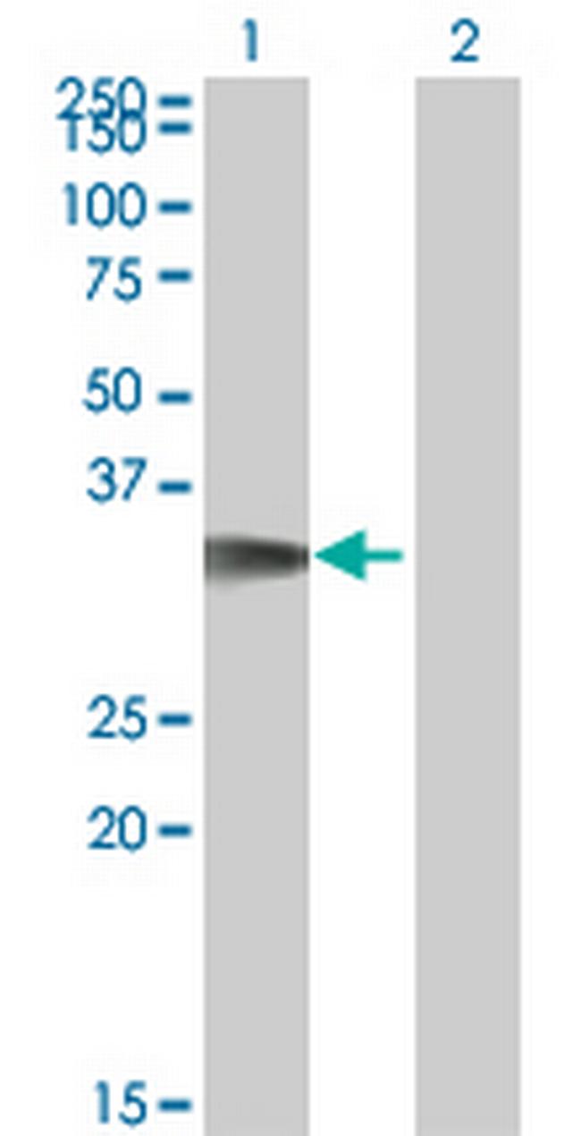 CDK5R1 Antibody in Western Blot (WB)