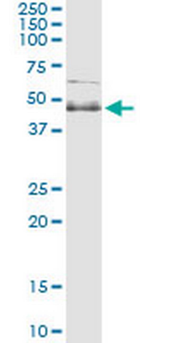 SPHK1 Antibody in Immunoprecipitation (IP)