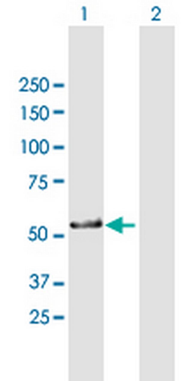 ZNF259 Antibody in Western Blot (WB)