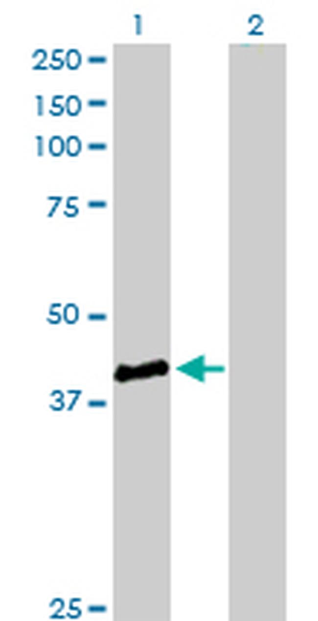 STBD1 Antibody in Western Blot (WB)