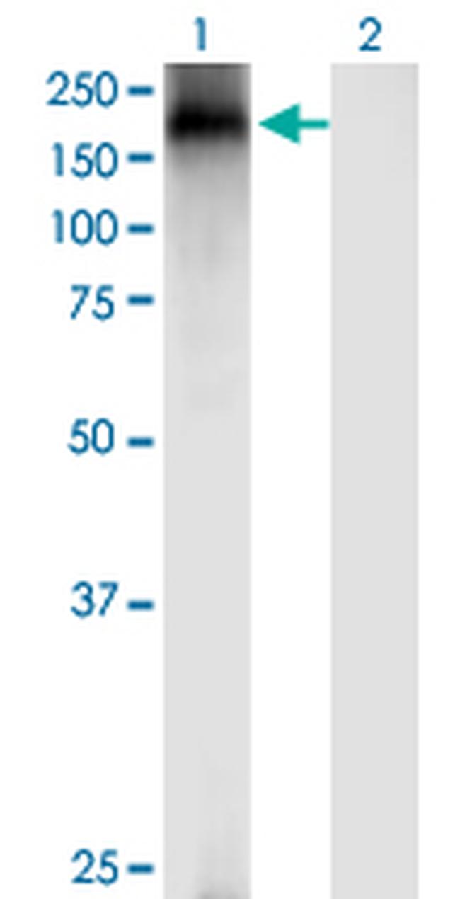 TRPA1 Antibody in Western Blot (WB)