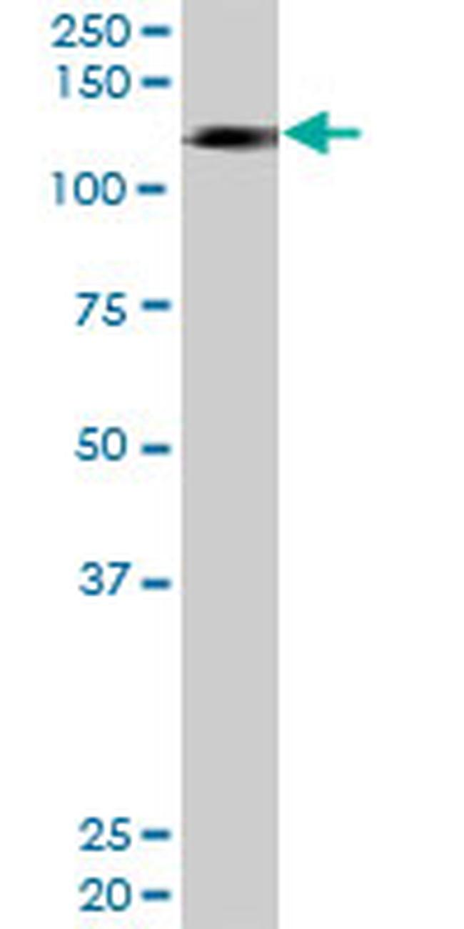 HIP1R Antibody in Western Blot (WB)