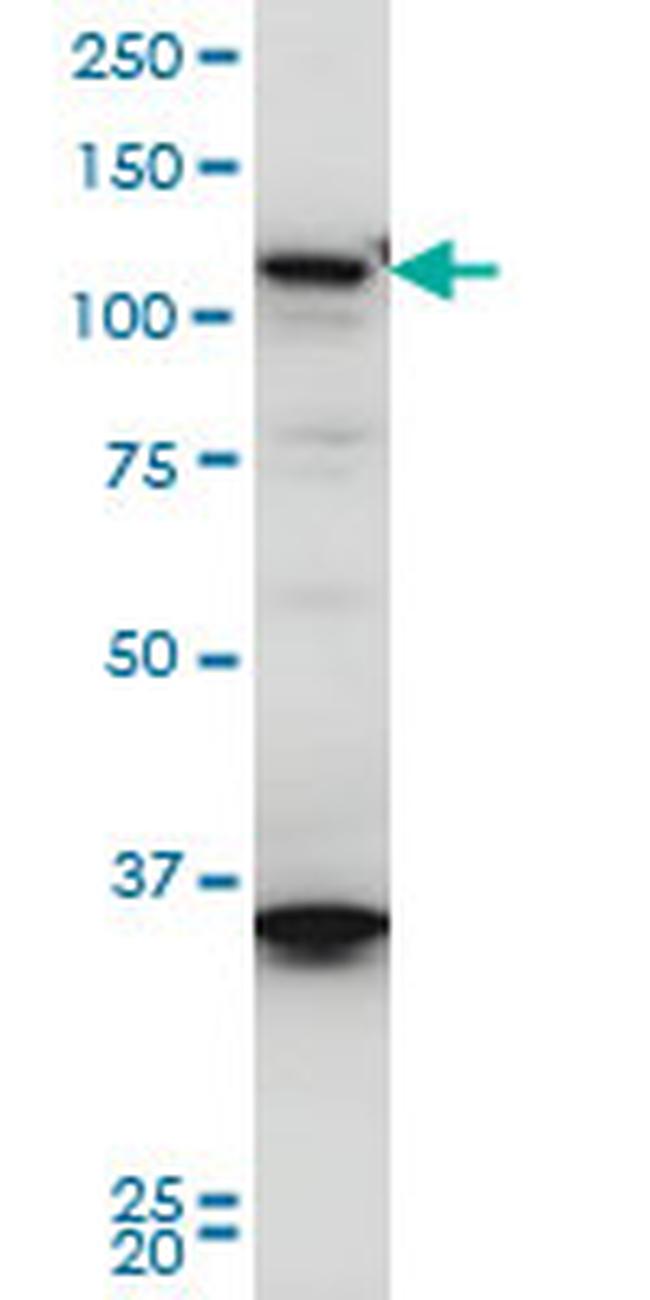 HIP1R Antibody in Western Blot (WB)