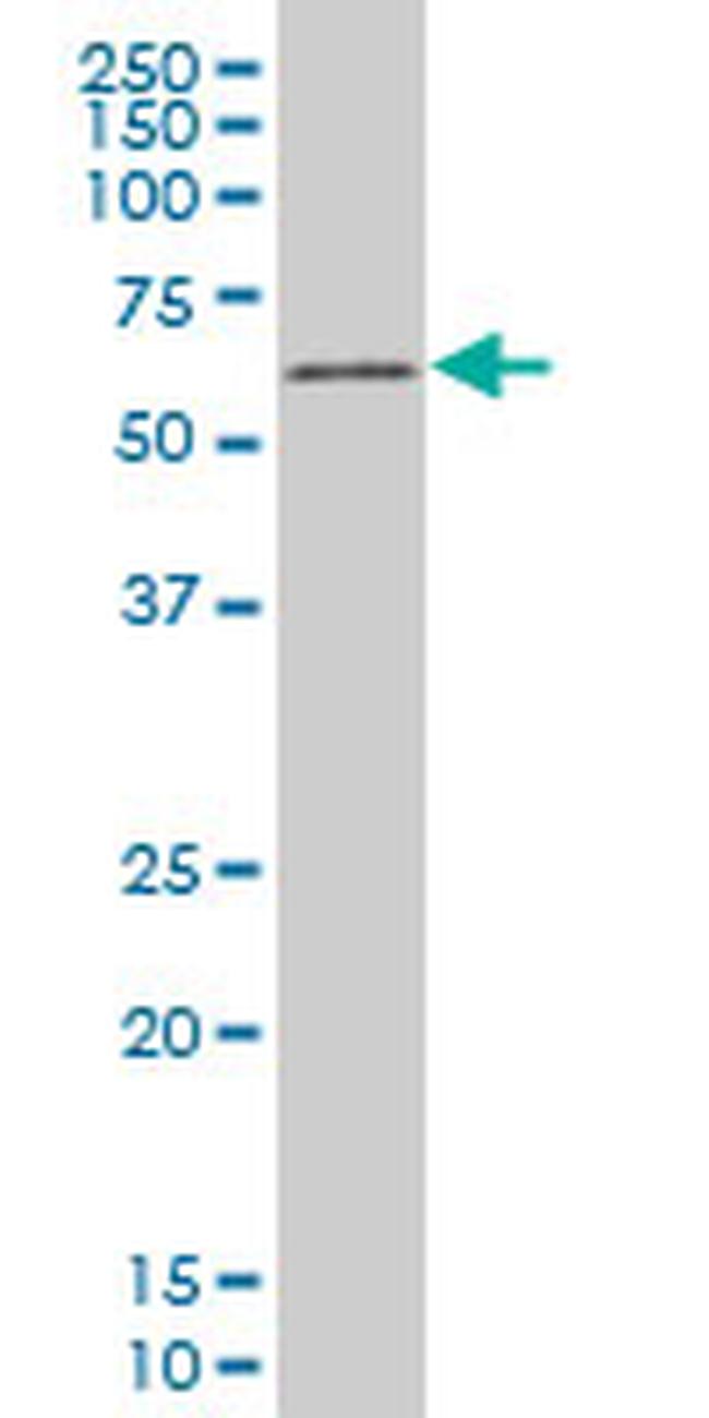 TBX18 Antibody in Western Blot (WB)