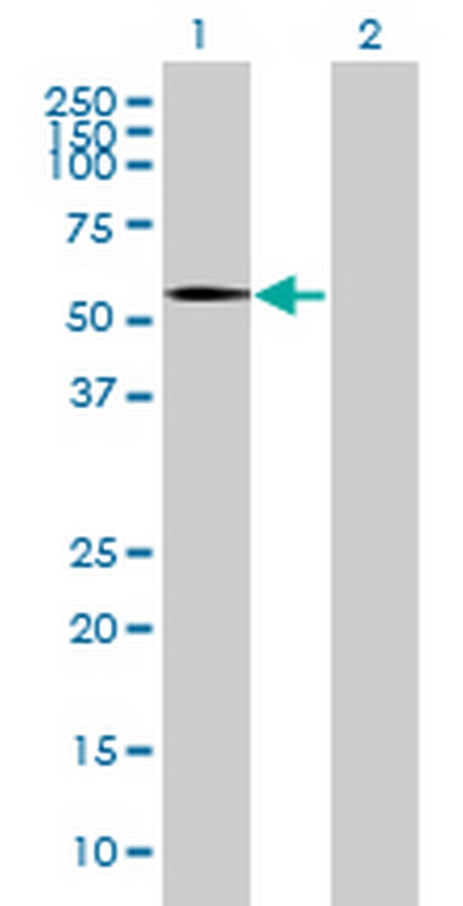 RNU3IP2 Antibody in Western Blot (WB)