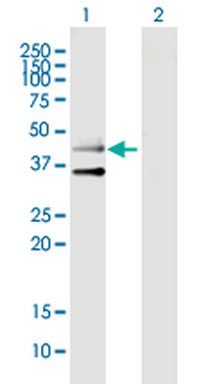 HTR3B Antibody in Western Blot (WB)