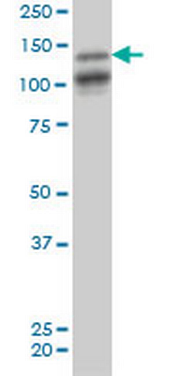 MAGI1 Antibody in Western Blot (WB)