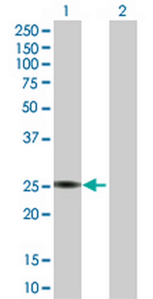 PTTG1 Antibody in Western Blot (WB)