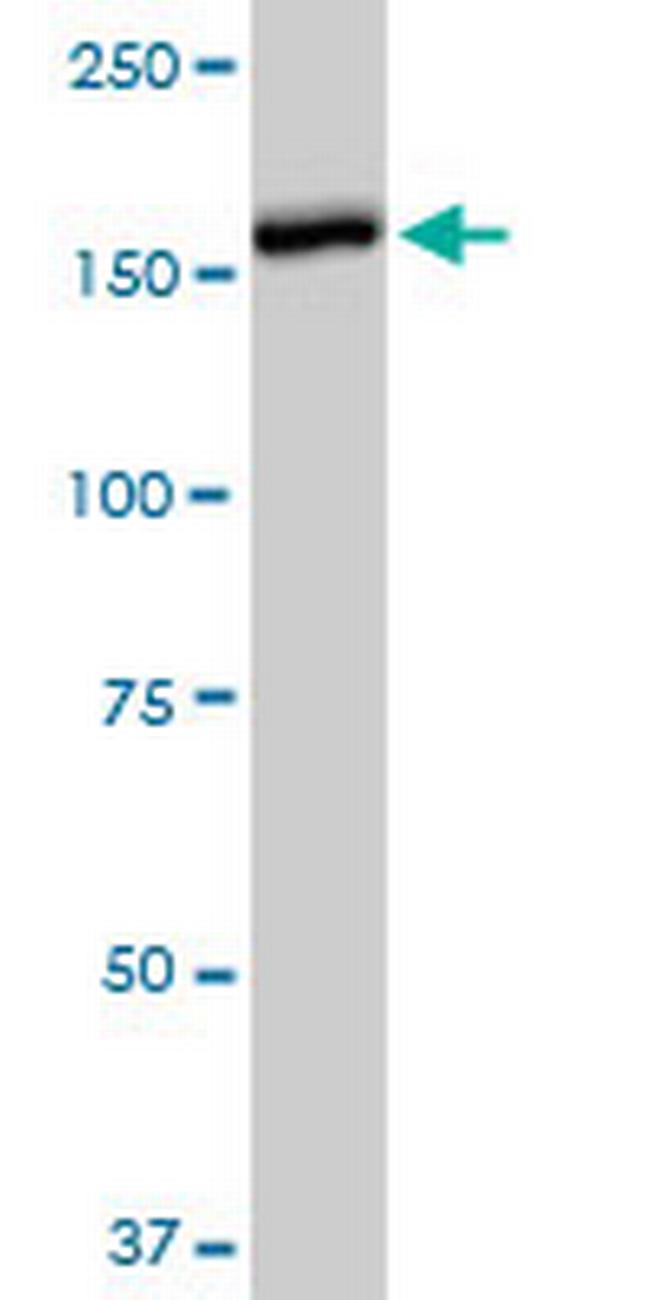 CACNA2D2 Antibody in Western Blot (WB)