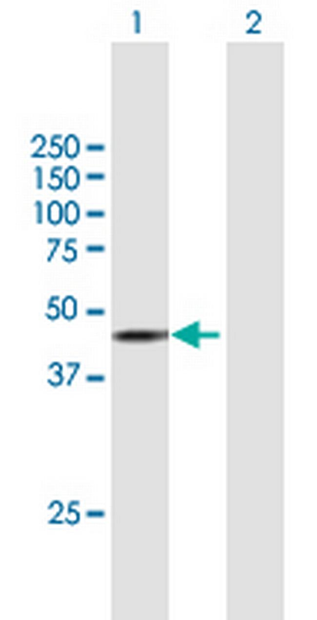 STK17B Antibody in Western Blot (WB)