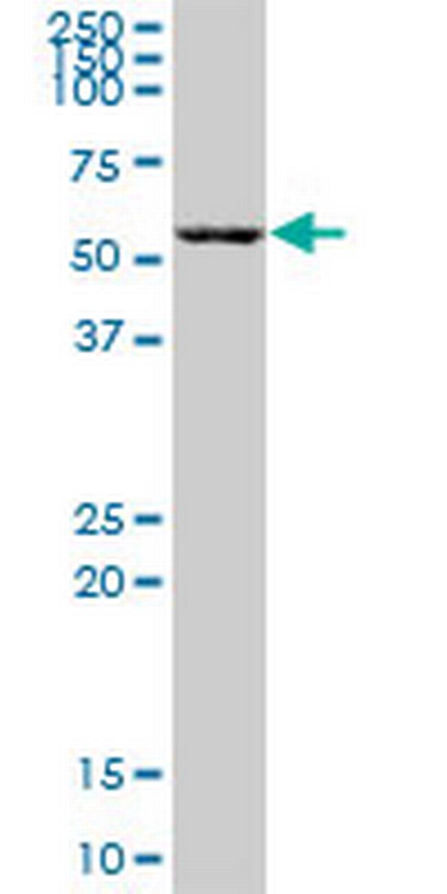 ZBTB22 Antibody in Western Blot (WB)